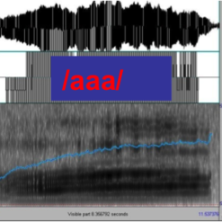 Pitch elevation