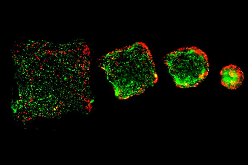 Inkjet-printed tumors